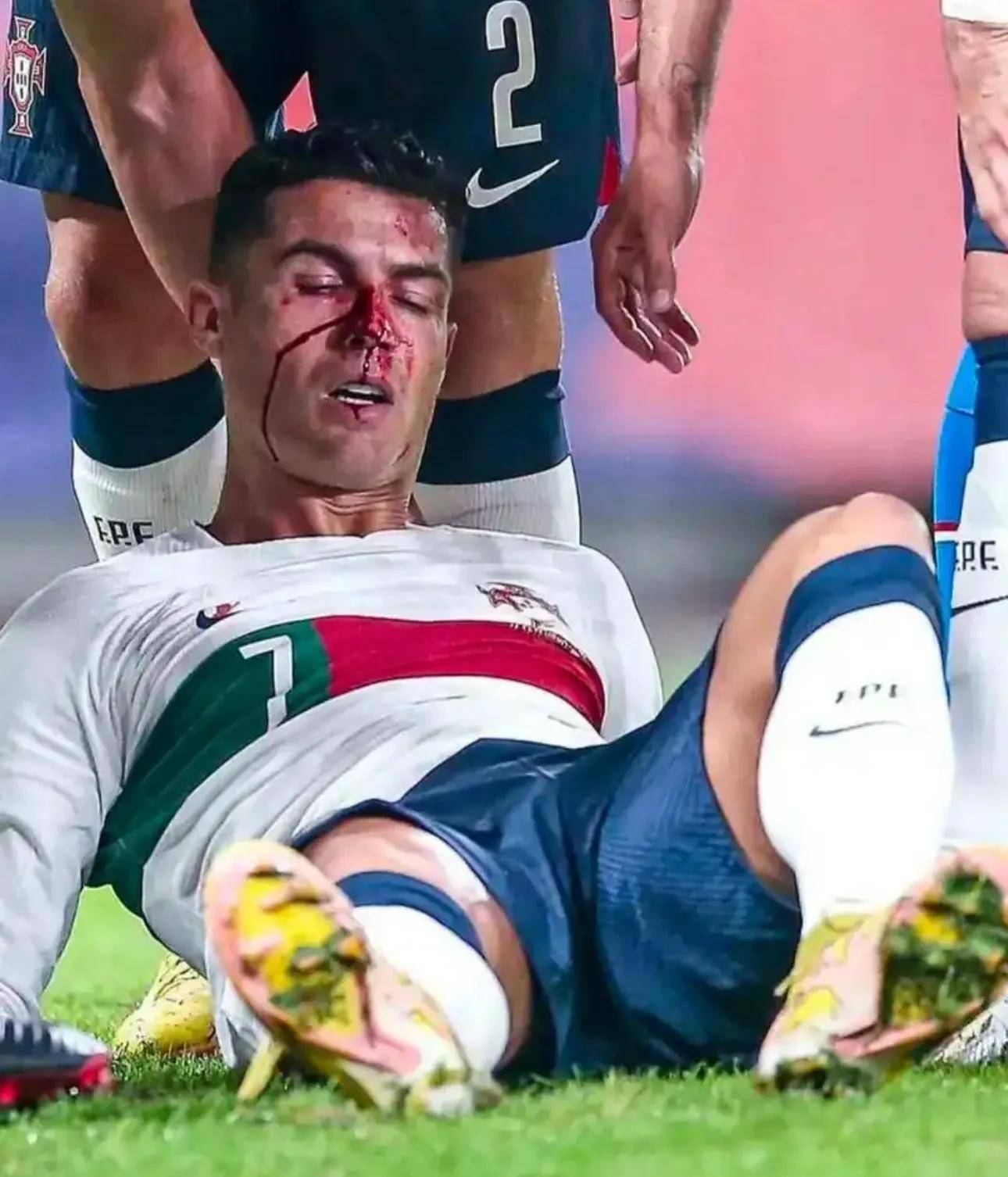 ballbet体育官网C罗在篮网比赛中战术调整，战术调整引发热议！的简单介绍